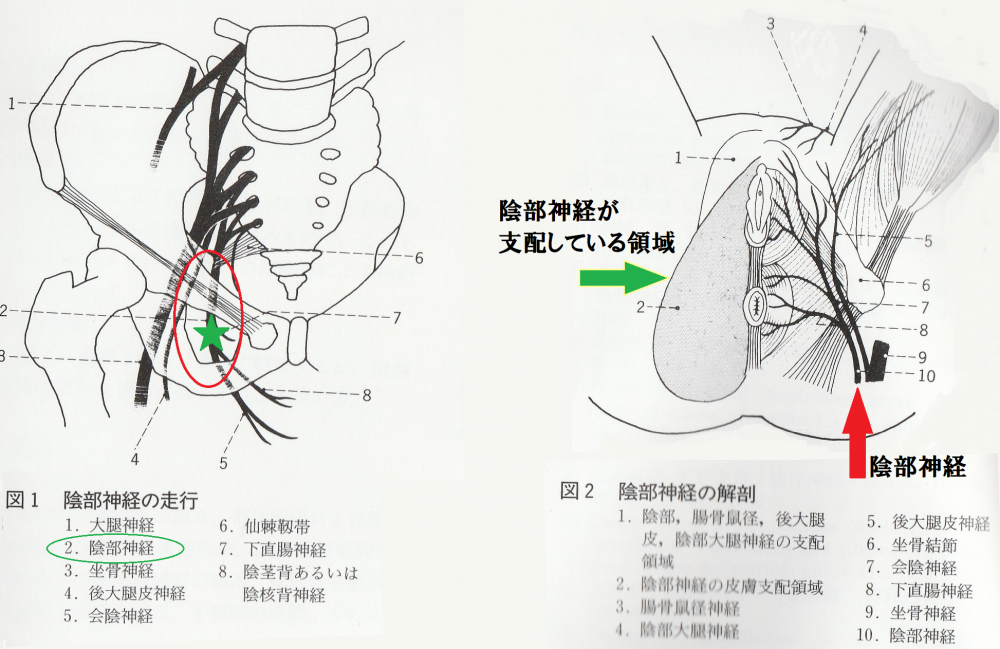 慢性前立腺炎 慢性骨盤痛症候群には陰部神経刺鍼が必須です 名古屋市緑区 はり 灸 マッサージ 指圧 ライフ治療院